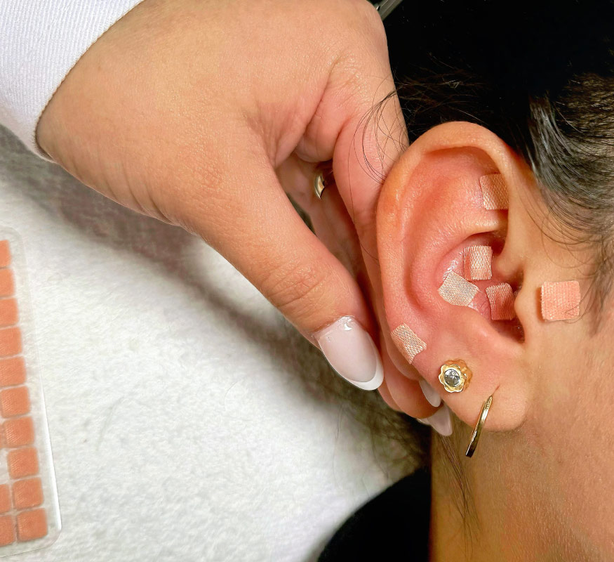 oreja-con-balines-sesion-de-auriculoterapia-peru